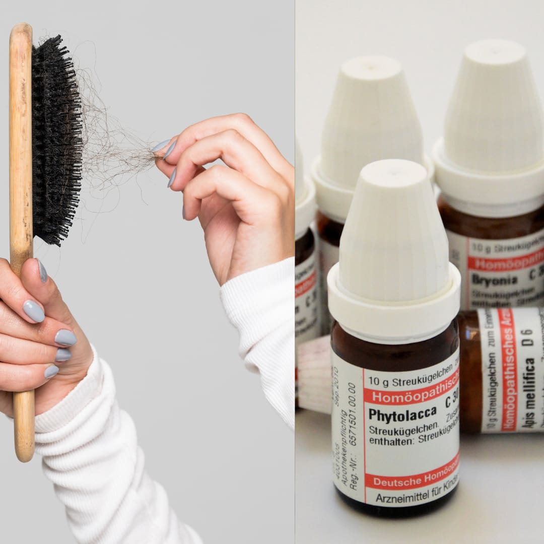 8 Wonderful Homeopathic remedies which can help control HAIR FALL!
