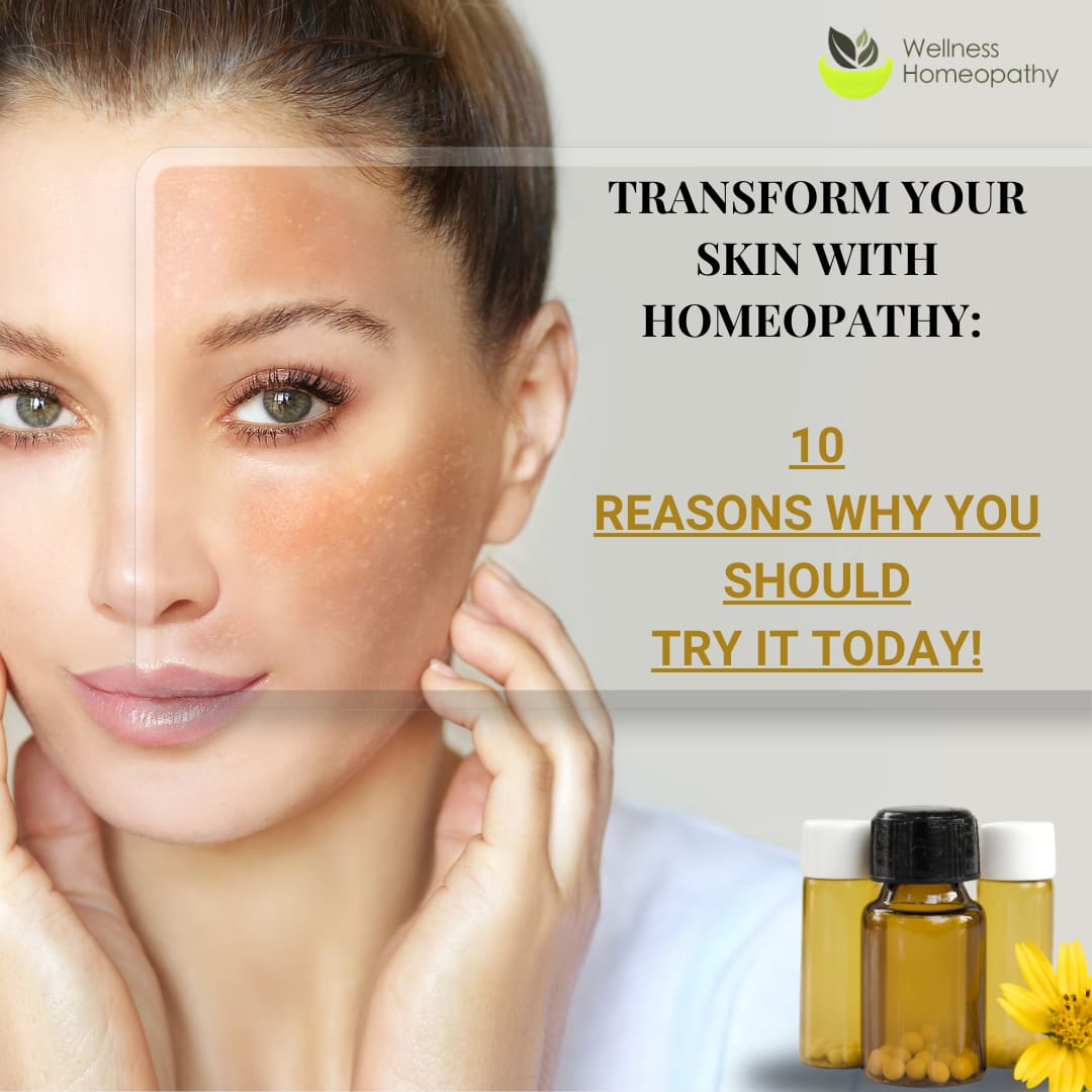 Transform Your Skin with Homeopathy: “10 Reasons Why You Should Try it Today!”