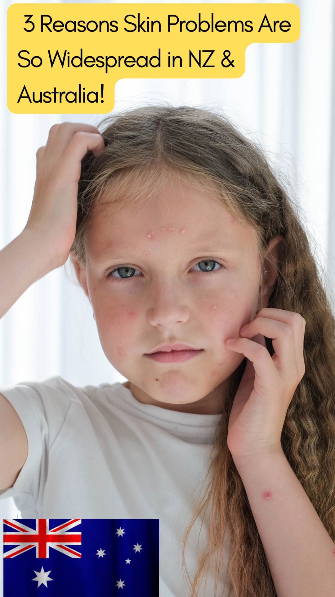 3 Reasons Skin Problems Are So Widespread in NZ & Australia
