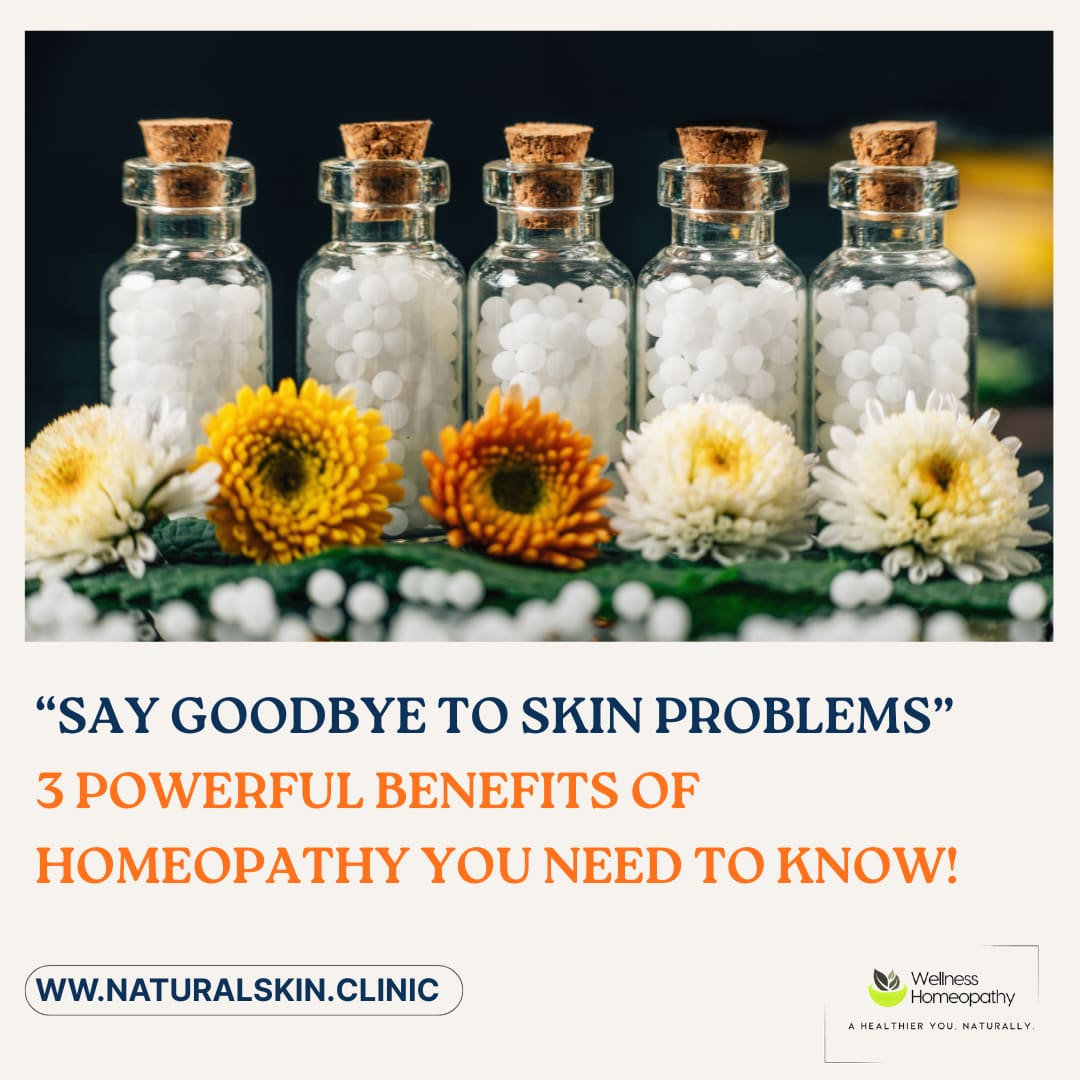 “Say Goodbye to Skin Problems” : 3 Powerful Benefits of Homeopathy You Need to Know!